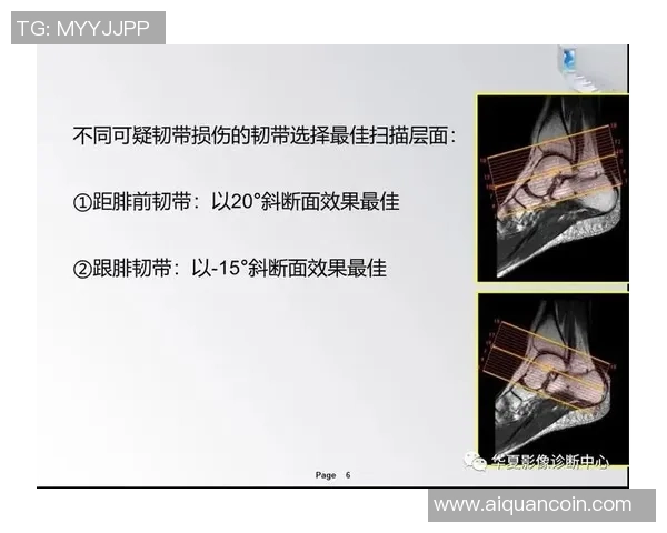 足球脚肌肉的力量与灵活性训练方法解析及其对运动表现的影响
